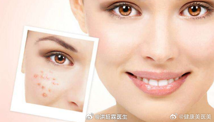 科痘窝最新欢乐日常分享